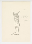 Illustration, p. 75: “Varicose Veins #19” Drawing of a Bandaged Leg by Medical Arts Publishing Foundation