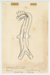 Illustration, p. 113: “Cardiac Clinic: Dissecting Aneurysm of the Aorta” Ink Drawing by Medical Arts Publishing Foundation
