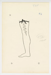 Illustration, p. 73: “Varicose Veins #6” Drawing of Vein in Leg by Medical Arts Publishing Foundation