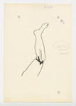 Illustration, p. 73: “Varicose Veins #8” Drawing of Vein in Leg by Medical Arts Publishing Foundation