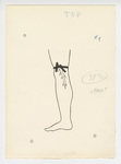 Illustration, p. 73: “Varicose Veins #9” Drawing of Vein in Leg by Medical Arts Publishing Foundation