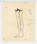 Illustration, p. 73: “Varicose Veins #11, 14, 15” Drawing of Vein in Leg by Medical Arts Publishing Foundation