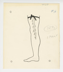 Illustration, p. 73: “Varicose Veins #13” Drawing of Vein in Leg by Medical Arts Publishing Foundation