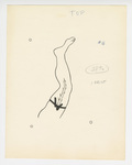 Illustration, p. 75: “Varicose Veins #16” Drawing of Vein in Leg by Medical Arts Publishing Foundation