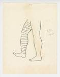 Illustration, p. 75: “Varicose Veins #18” Drawing of Vein in Leg by Medical Arts Publishing Foundation