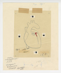 Illustration, p. 4: “Heart with Block” drawing by Medical Arts Publishing Foundation
