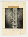 Illustration, p. 75: X-ray Image of Spine by Medical Arts Publishing Foundation