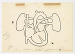 Illustration, p. 74: “Heart and Lungs” Drawing by Medical Arts Publishing Foundation