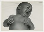 Half Body Shot of Distressed Infant by Medical Photography Department, Ben Taub General Hospital (Houston, Tex.)